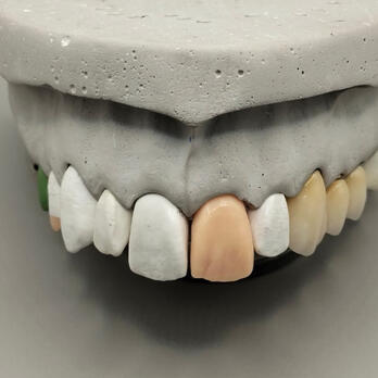 Encerado dental